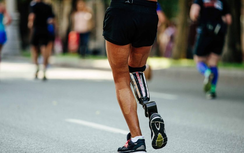female runner disability in prosthesis