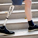 Young man with prosthetic leg walking outdoors along the stairs