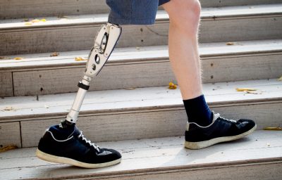 Young man with prosthetic leg walking outdoors along the stairs