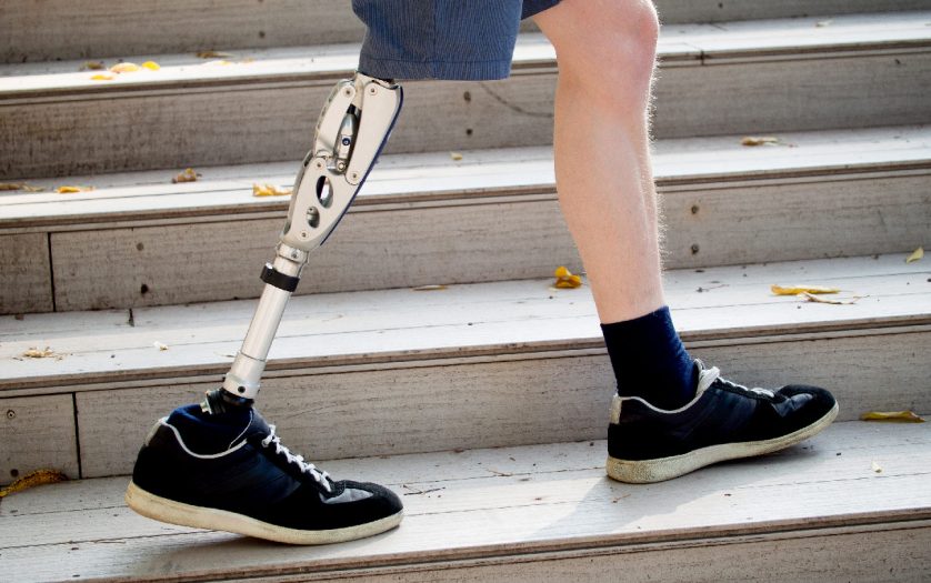 Young man with prosthetic leg walking outdoors along the stairs