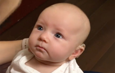 baby girl with hearing disability looking at mom