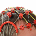 Patient on the epilepsy examination
