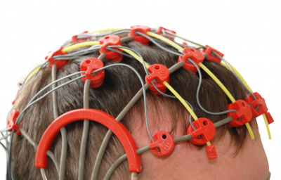 Patient on the epilepsy examination
