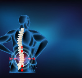 Diagram showing herniated disc in human