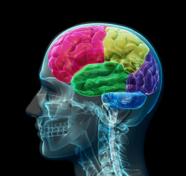 Colored sections of a male human brain ,x ray concept