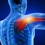 3d rendered illustration of a man having a painful shoulder