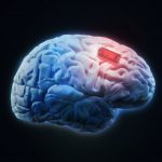 Human brain implant concept illustration