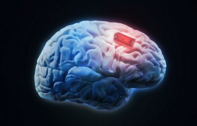 Human brain implant concept illustration