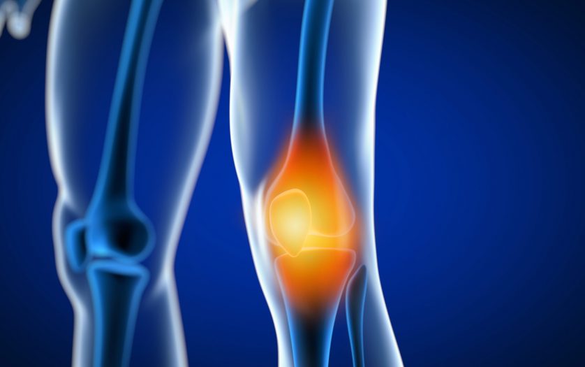 Painful Knee