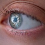 Woman's eye with implants
