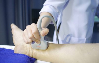 Skillful sonographer using ultrasound machine in hospital for diagnosis at left leg for finding posterior tibial vein suspected deep vein thrombosis
