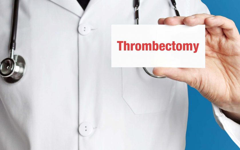 Doctor in smock holds up Thrombectomy card.