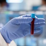 Close up of doctor holding sample of blood in vaccutainer