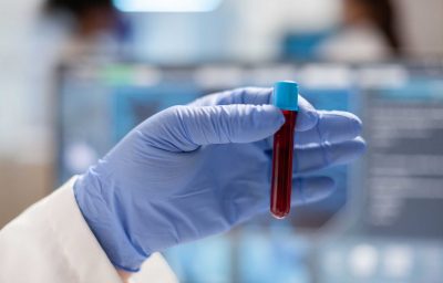 Close up of doctor holding sample of blood in vaccutainer