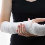 Close-up of Female Broken Arm in Plaster Cast
