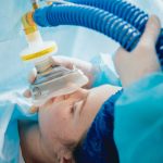 Pre oxygenation for general anesthesia