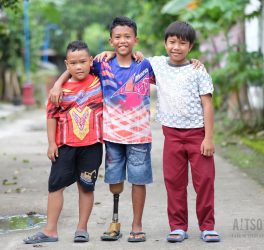 Three children standing with their arms around each other's shoulders. The child in the middle has a prosthetic leg.