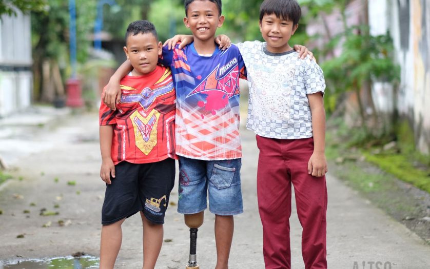 Three children standing with their arms around each other's shoulders. The child in the middle has a prosthetic leg.