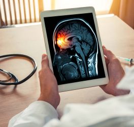 Doctor holding a digital tablet with x-ray of brain and skull skeleton
