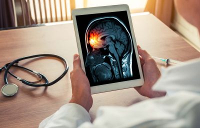 Doctor holding a digital tablet with x-ray of brain and skull skeleton