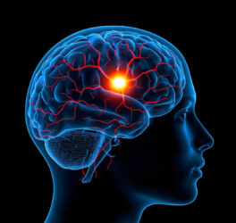 head with an X ray showing the brain highlighted in red