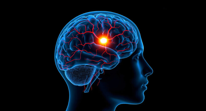 head with an X ray showing the brain highlighted in red
